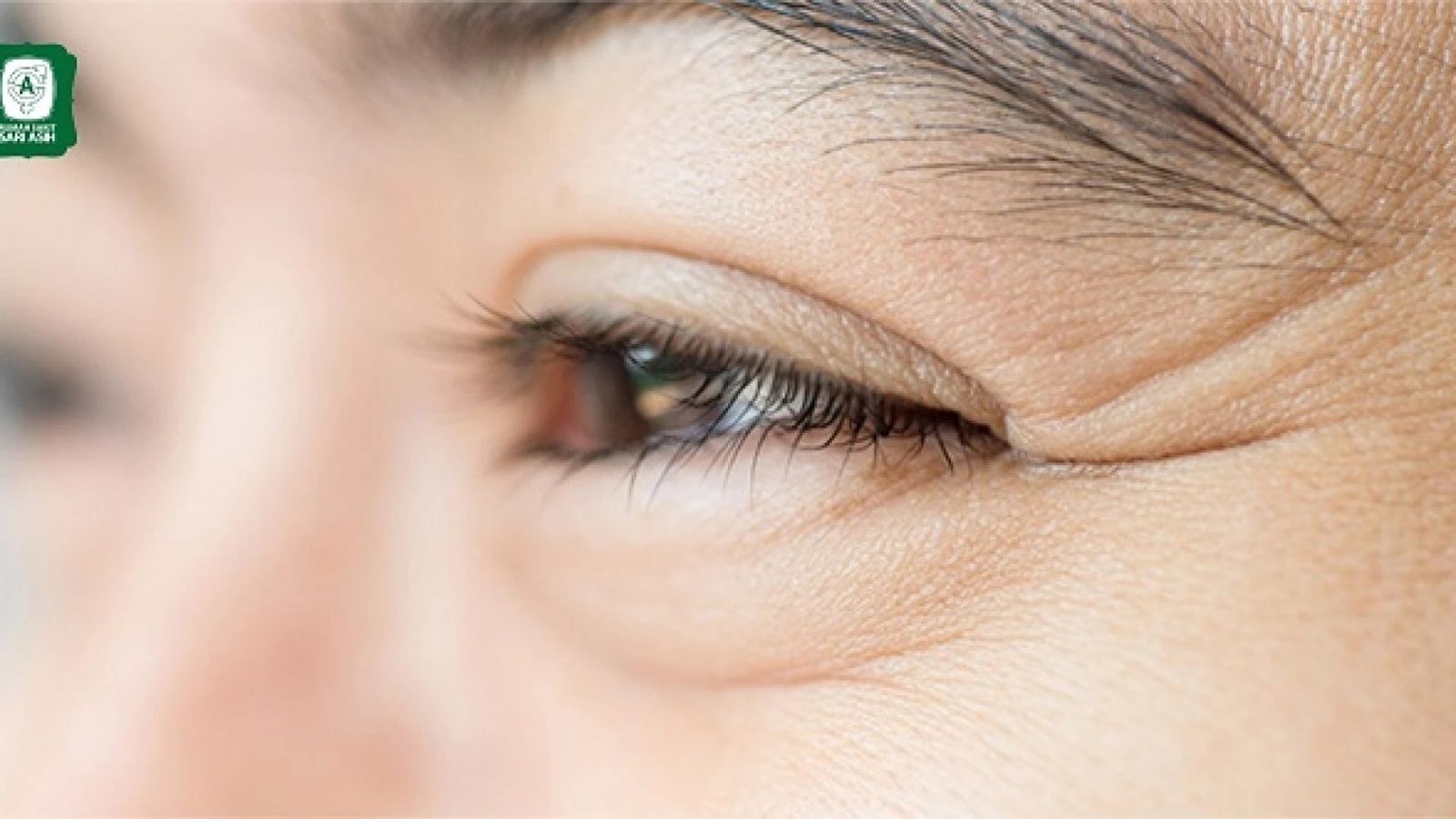 Apa Arti Kedutan Mata Kanan Bawah Menurut Islam? Ini Penjelasannya