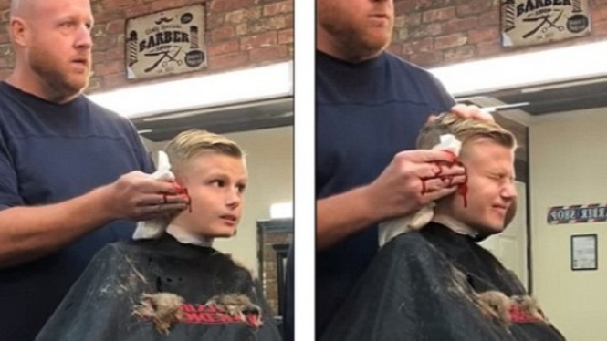 Anak Kecil Histeris, Usai Tukang Cukur Potong Telinganya