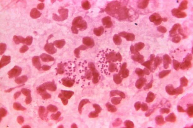 Usai Gauli Wanita Asia, Pria Inggris Idap Super-Gonorrhea Terburuk di Dunia