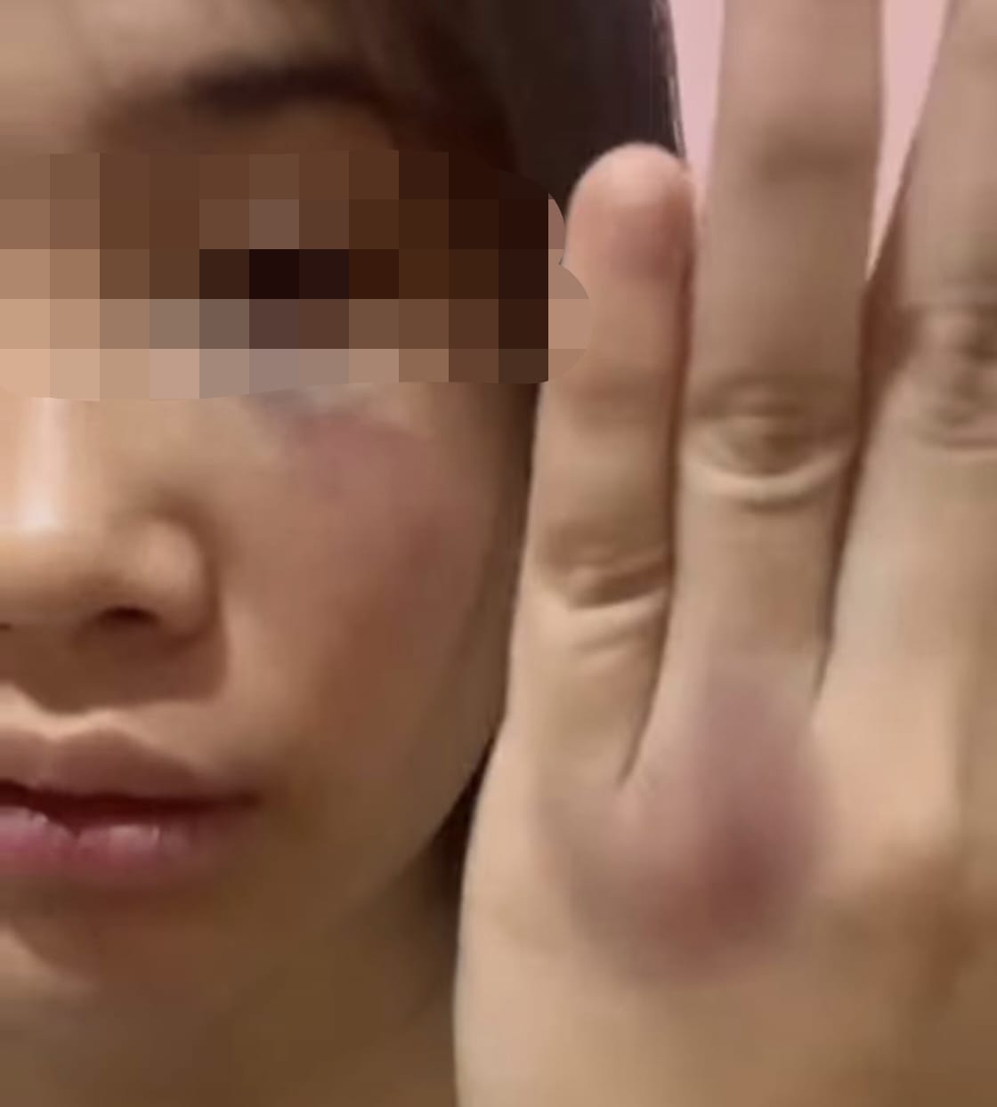 Polisi Masih Lidik Kasus Dugaan Penganiayaan Mantan Pacar di Pekanbaru