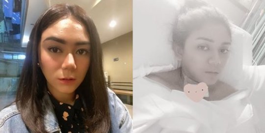 Pasca Operasi Langsung Diserang Komentar Pedas