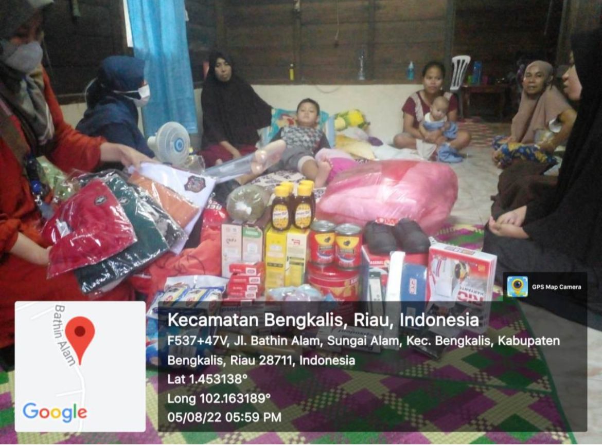 Anak Yatim, Rehan Patah Tulang Paha Terima Bantuan Kemensos Republik Indonesia 