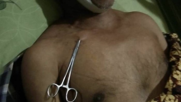 Heboh! Saat Pembungkus Mayat Dibuka, Ada Benda Mirip Gunting Menempel di Dada Jenazah Jamiran