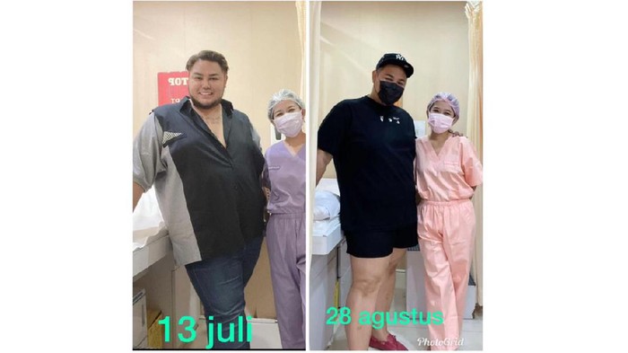 Ivan Gunawan Buka-bukaan Soal Berat Badan, Kok Bisa Sebulan Turun 21 Kg?