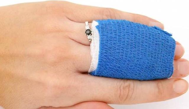 Tips Menghentikan Luka Berdarah dalam 15 Detik