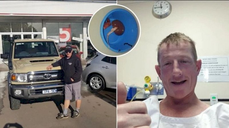 Beli Mobil Idaman Tapi Tak Punya Uang, Pria Ini Akhirnya Menjual Satu Ginjalnya