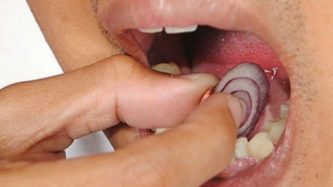 7 Obat Sakit Gigi Alami, Bekerja Sangat Cepat dan Efektif