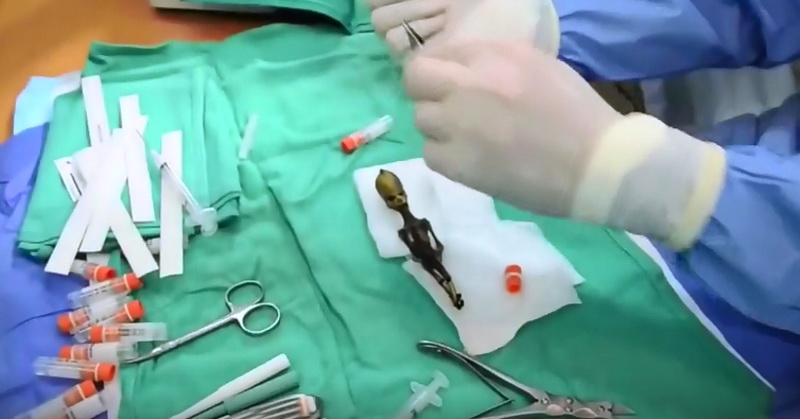 Peneliti Ungkap Mumi Alien Ternyata Bayi Manusia