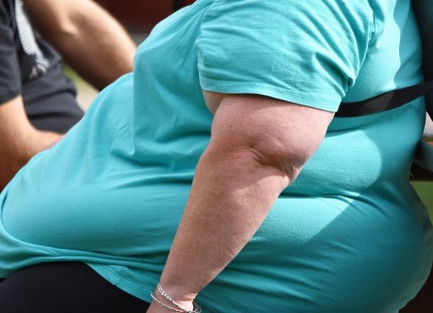 Wah! Perempuan yang Tinggal di Dekat Ruang Terbuka Hijau Cenderung Gemuk, Ini Ilmiahnya