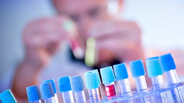 Terima Sampel Dari BNNK, Senin BPPOM Sampaikan Hasil Tes ke 56 Pelajar Pekanbaru yang Sayat Tangan