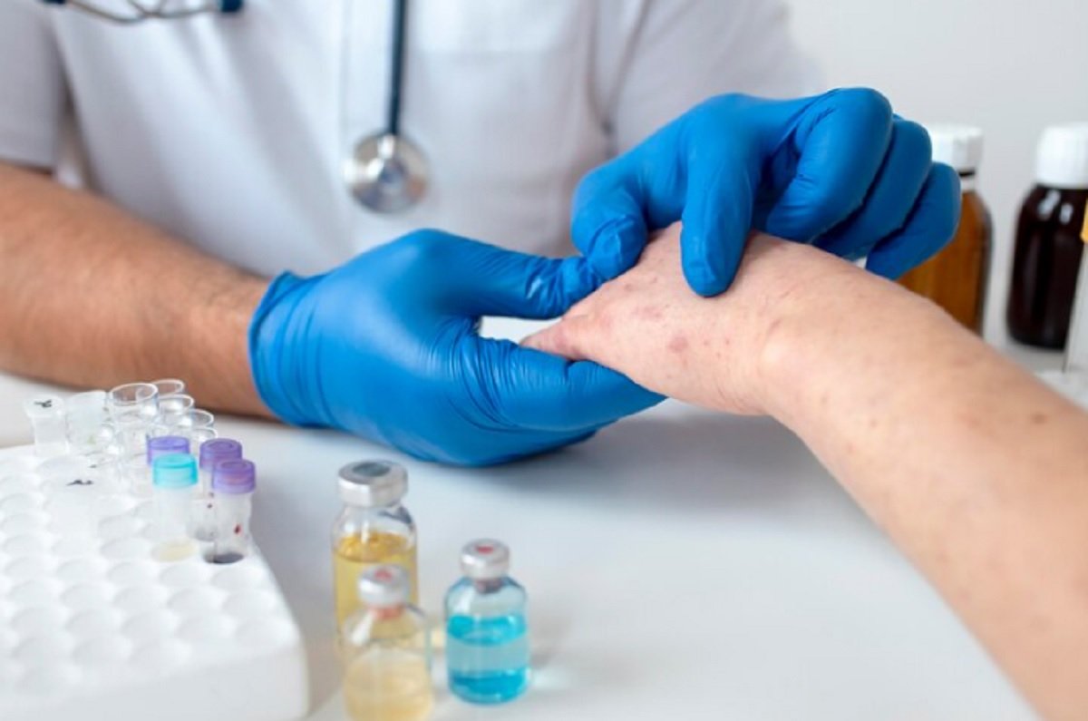 Bisakah Penyakit Autoimun Bisa Disembuhkan? Ini Kata Dokter Penyakit Dalam