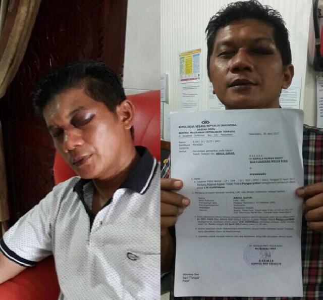 Aniaya Teman Separtai Hingga Babak Belur, Anggota DPRD Riau Yusuf Sikumbang Dilaporkan ke Polda
