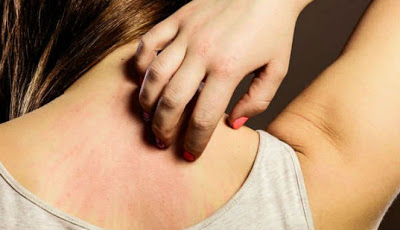 Gejala Kanker yang 90 Persen Diabaikan Orang-orang