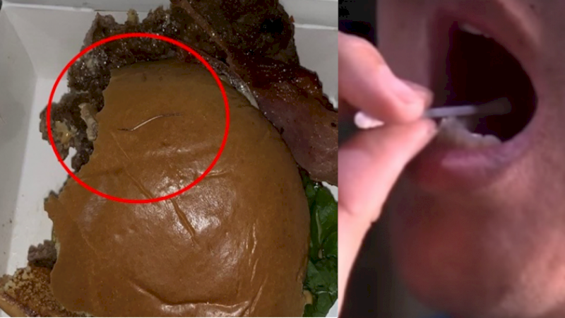 Duh! Lidah Pria Ini Terluka Setelah Makan Burger, Pas Dicek Ada Jarum Panjang