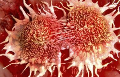 Ngeri Juga Ya, Penyakit Kanker yang Selalu Terjadi Pada Wanita