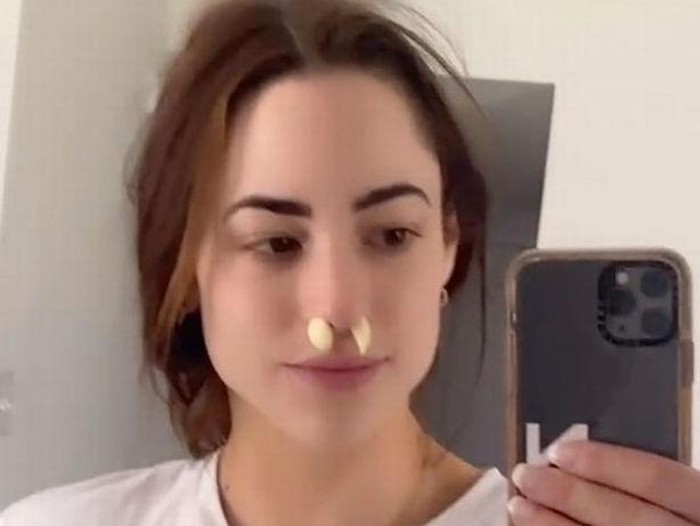 Coba Redakan Sinus, Wanita Ini Taruh Bawang Putih di Lubang Hidung