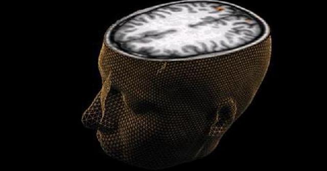 Wow, Ilmuwan Ingin Hidupkan Kembali Otak Mati