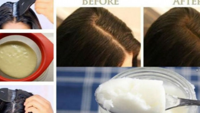 3 Bahan Ini Ampuh Tebalkan Rambut Tipis dalam Semalam