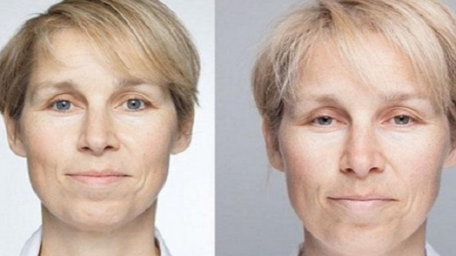 5 Kondisi Akibat Kurang Tidur, Nomor 3 Sebabkan Kematian