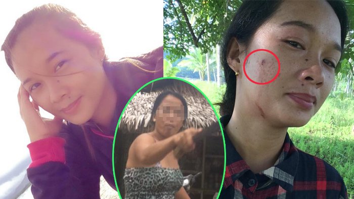 Viral Wanita Datangi Teman untuk Tagih Utang, tapi Balasannya Mengerikan, Pipi sampai Berdarah