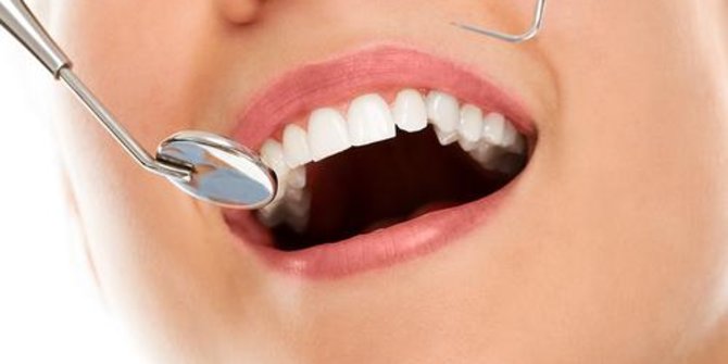 Berikut 7 Cara untuk Menjaga Kesehatan Gusi dan Memperkuatnya