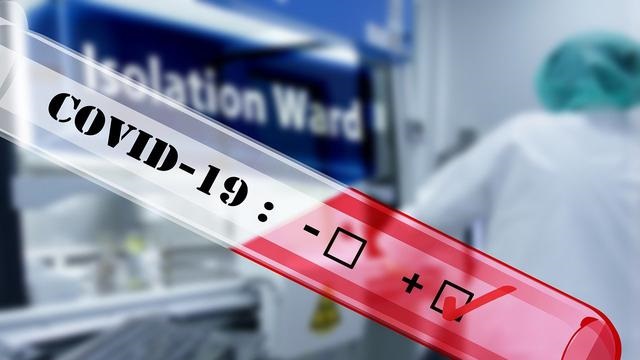 Hari Ini, Riau Sumbang 53 Pasien Positif Covid-19