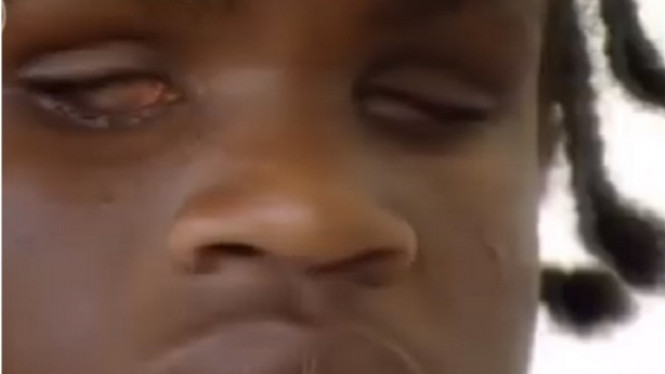 Meskipun Buta, Remaja Ini Bisa 'Melihat' Secara Normal