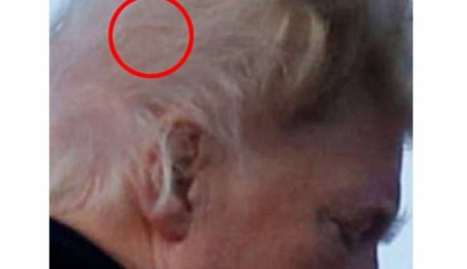 Misteri Rambut Presiden Amerika Donald Trump
