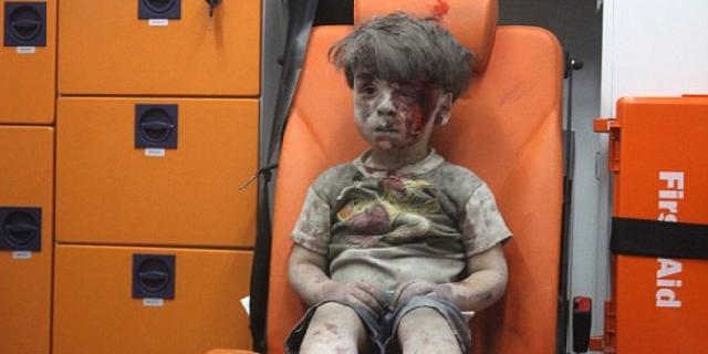 Video bocah Suriah duduk sendirian di ambulans bikin dunia terhenyak