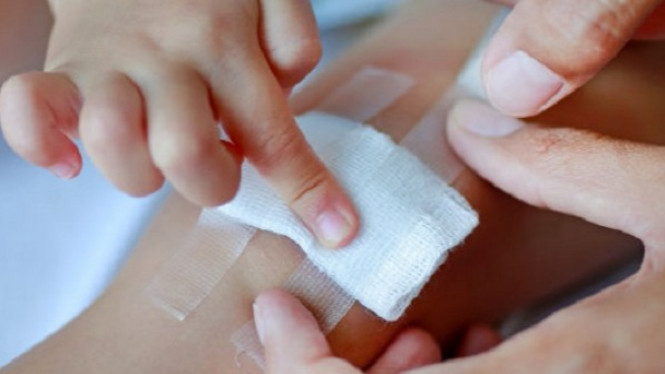 Terluka, Tempelkan Bawang Putih untuk Mengobatinya