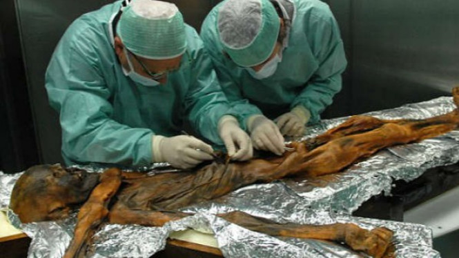 Terungkap Makanan Terakhir Mumi Otzi yang Berumur 5.300 Tahun