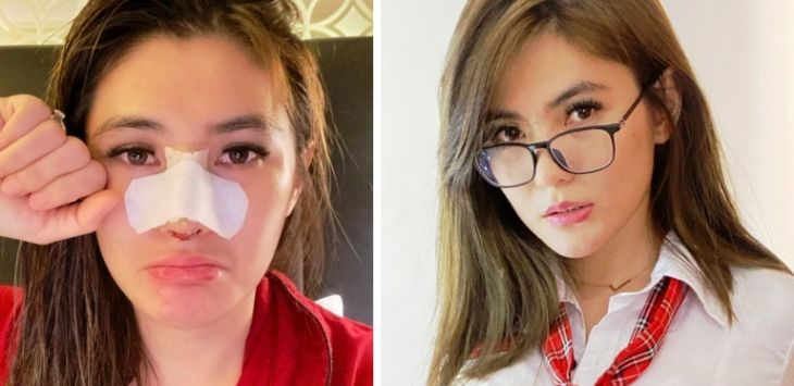 Oplas Hidung, Angela Lee : Saya Anti Munafik