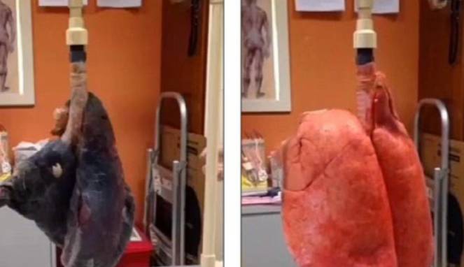 Cukup 60 Batang Rokok untuk Membuat Paru-paru Menghitam