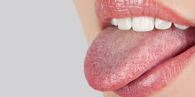 Yuk, Kenali Masalah Kesehatan yang Dialami dari Kondisi Lidah yang Kamu Miliki