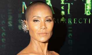 Apa Itu Alopecia, Penyakit Diderita Istri Will Smith?