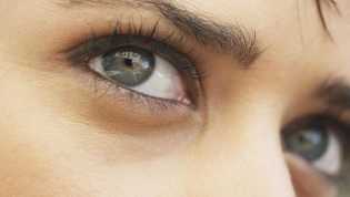 Apa Itu Ptosis? Kondisi 'Mata Ngantuk' yang Ramai Dibahas Warganet