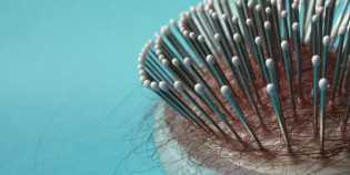 Lima Faktor yang Secara Mengejutkan Bisa Jadi Penyebab Rambut Rontok