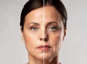 Milenial Rentan Alami Penuaan Dini, Ini Faktor Pemicunya