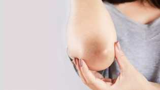 Berikut Perawatan Kecantikan untuk Atasi Sikut Gelap