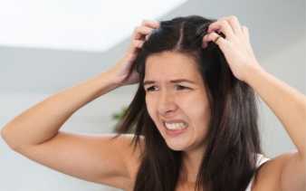 5 Cara Alami Ini Ampuh Usir Ketombe!