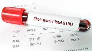 Berikut 6 Cara Sederhana Menurunkan Kolesterol