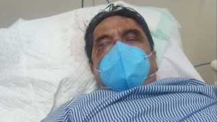 Berikut Lima Fakta Perdarahan Otak yang Dialami Ade Armando