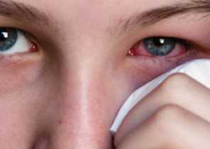 Empat Dampak Buruk Merokok pada Mata, Apa Saja?